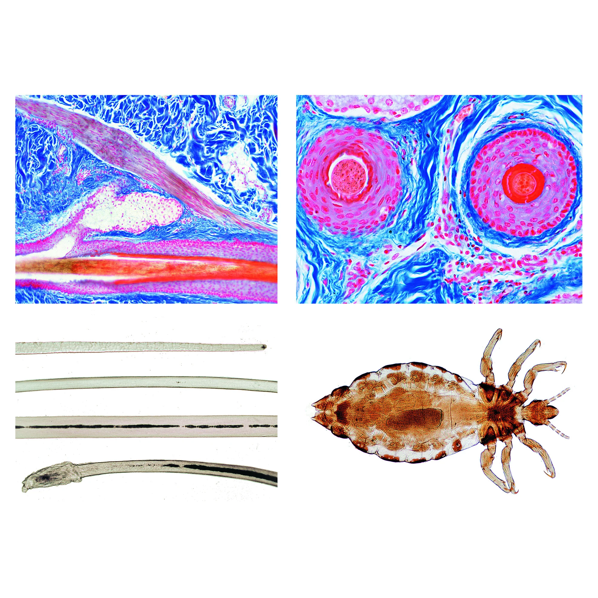 Cuir chevelu et cheveux (série coiffeur) (12 préparations)