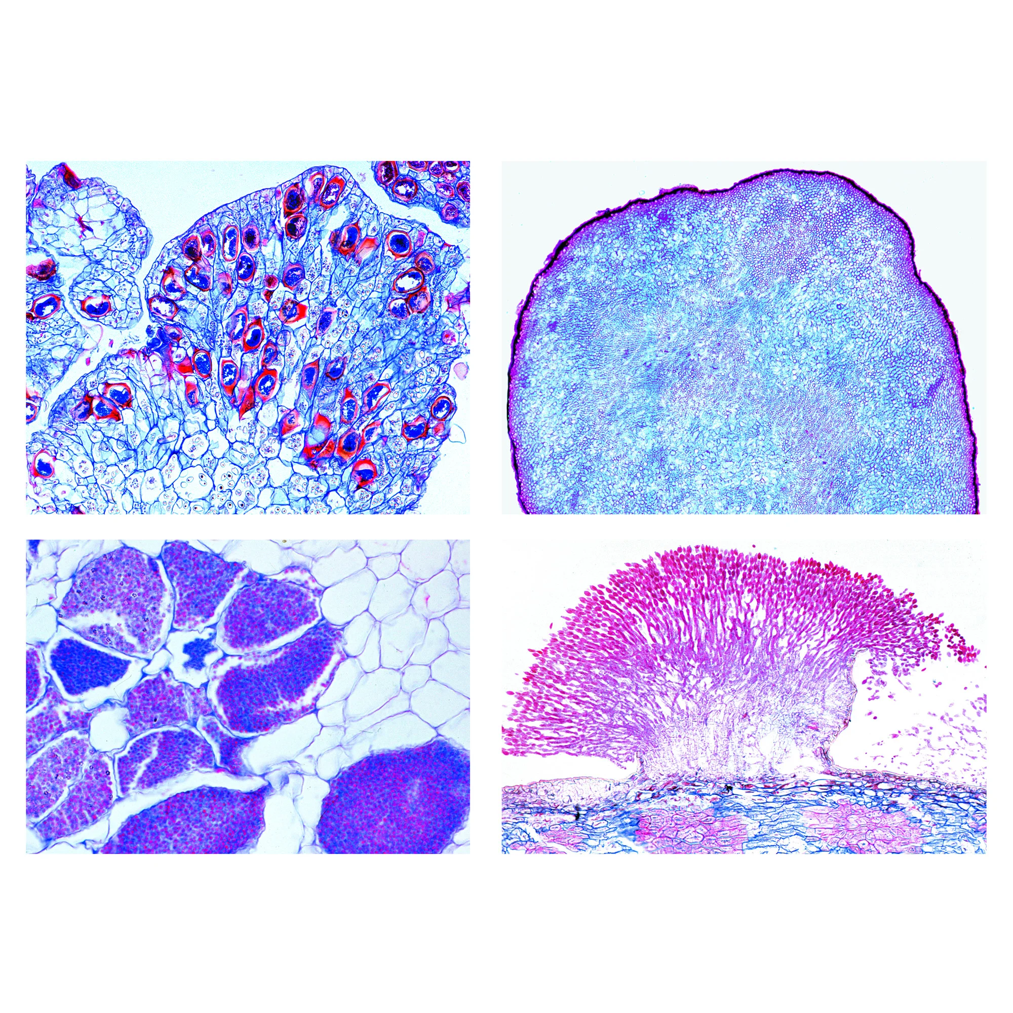 Maladies et parasites des cultures (20 préparations)