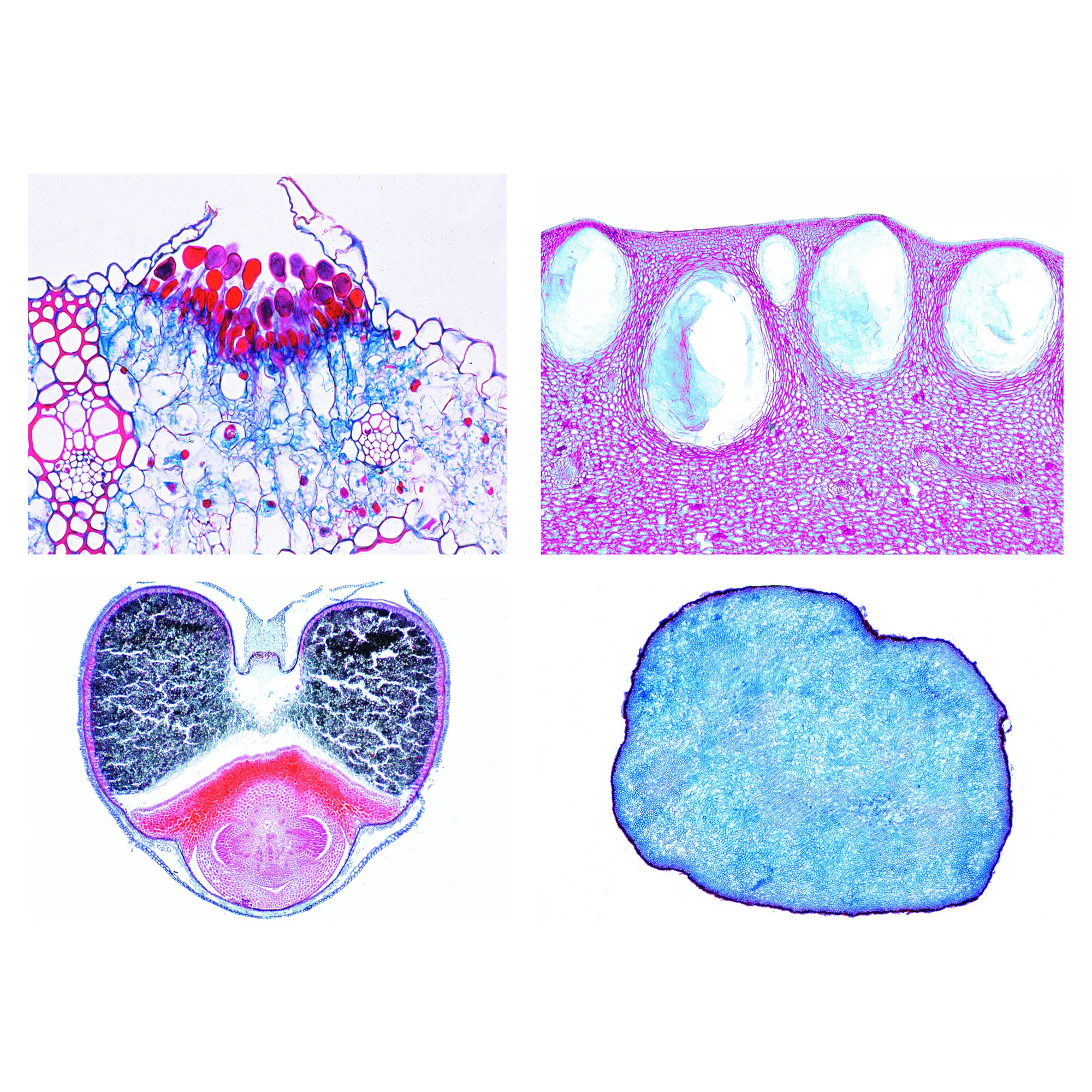 Variétés de farine et d'amidon, impuretés et adultérants, levures (25 préparations)