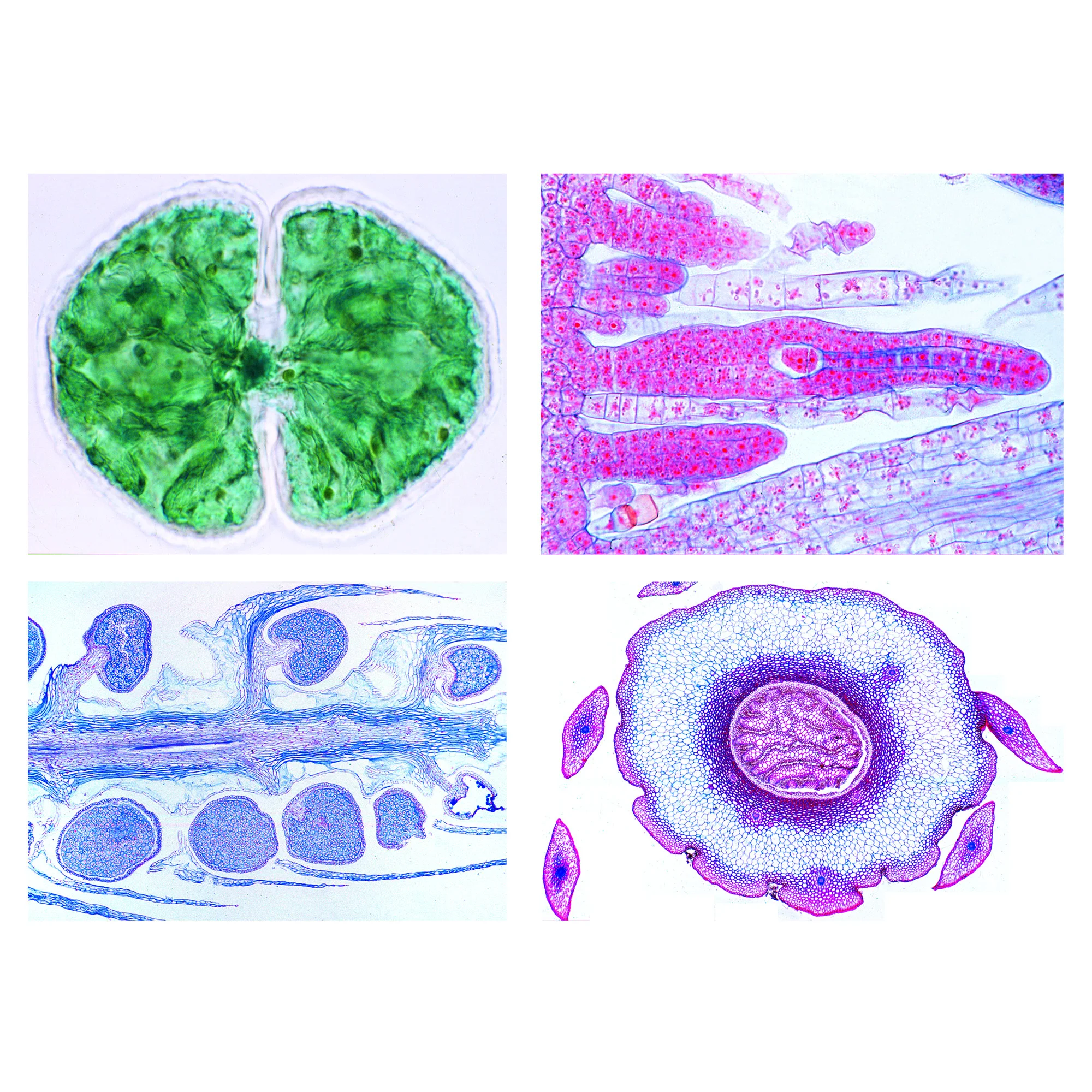 Plantes à fleurs (Phanerogamae), gamme de base. 25 préparations.