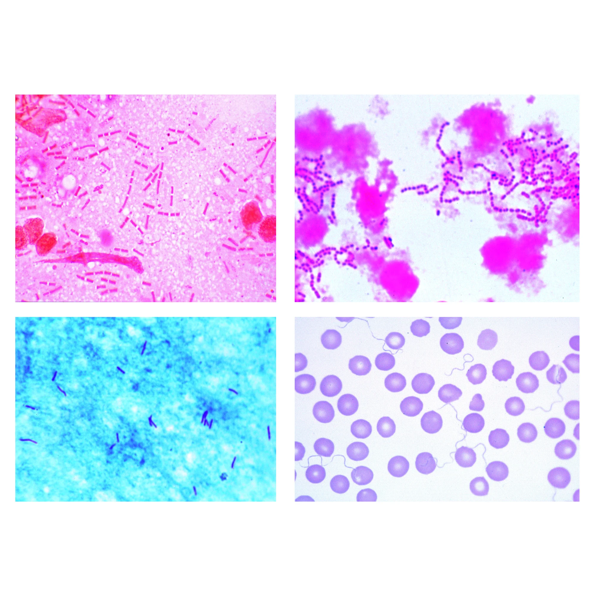 Les bactéries en tant qu'agents pathogènes. 25 préparations